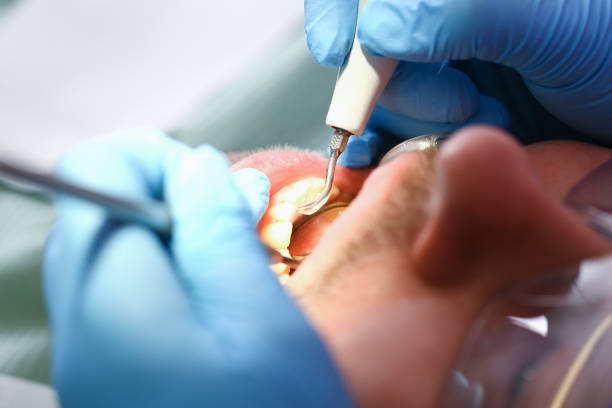 Best Dental Abscess Treatment in Franklin Center, NJ