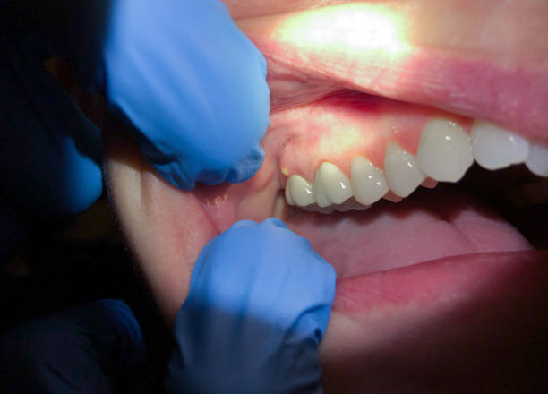 Best Emergency Root Canal Therapy in Franklin Center, NJ