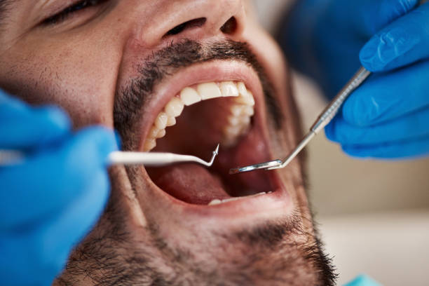 Best Urgent Dental Care for Toothaches in Franklin Center, NJ